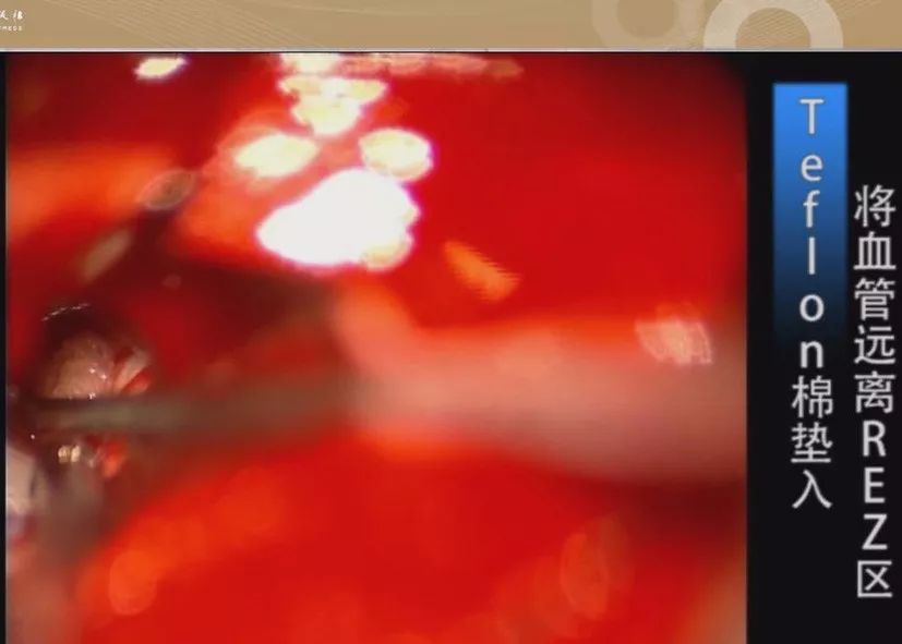 黍同人动漫海报